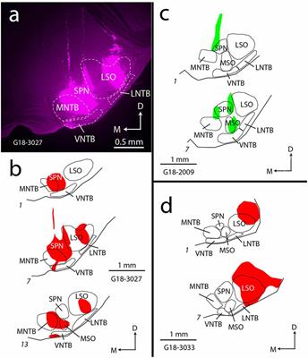 Multiple Sources of Cholinergic Input to the Superior Olivary Complex